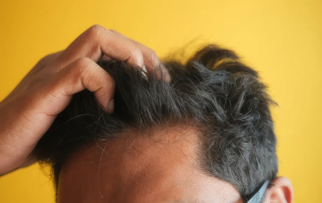 adult man scratching head against yellow backgroun utc