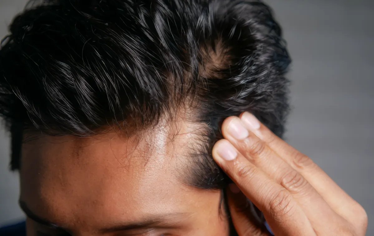 close up view of hairline with hand touching head utc
