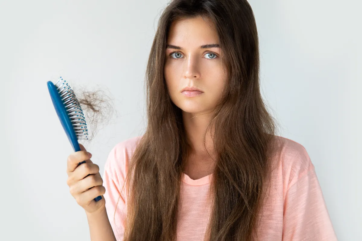 young woman is upset because of hair loss utc